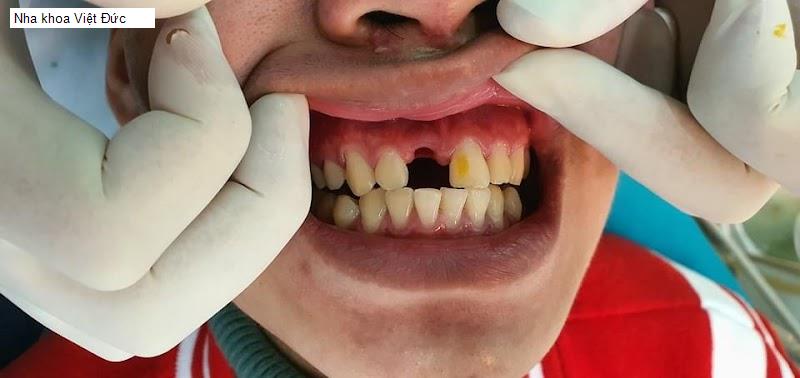 Nha khoa Việt Đức